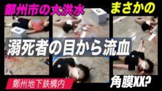 目から流血している洪水被害者を心配する声＝河南省鄭州市